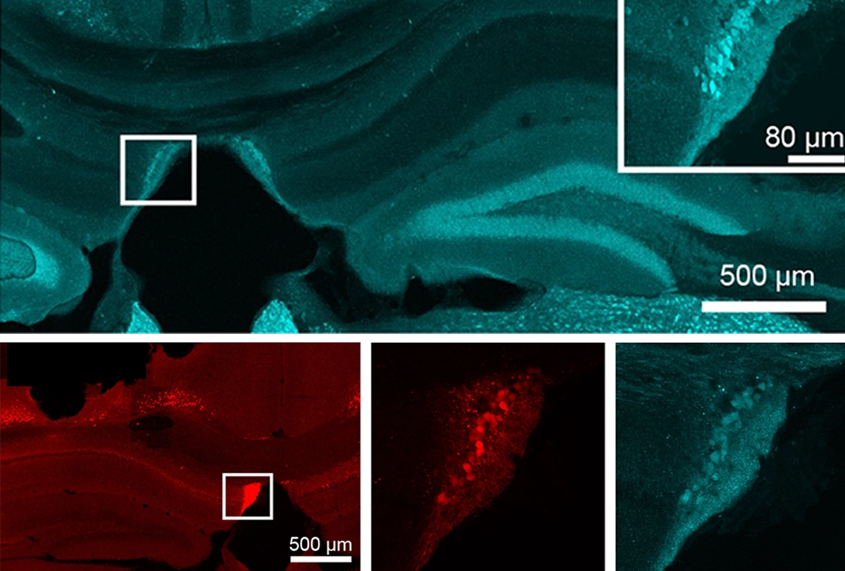 Research image of neurons in a small section of the hippocampus.