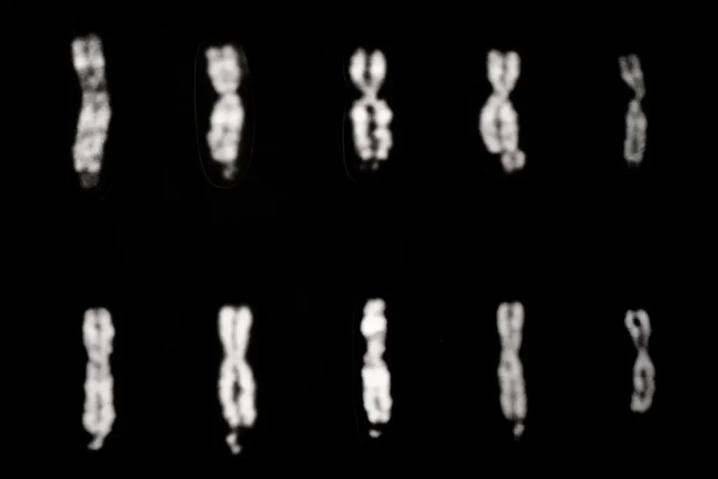 A research image of X chromosomes with Fragile X syndrome