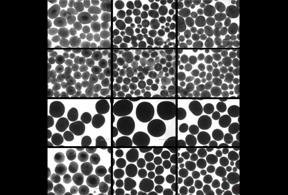 Black-and-white research image of brain organoids.