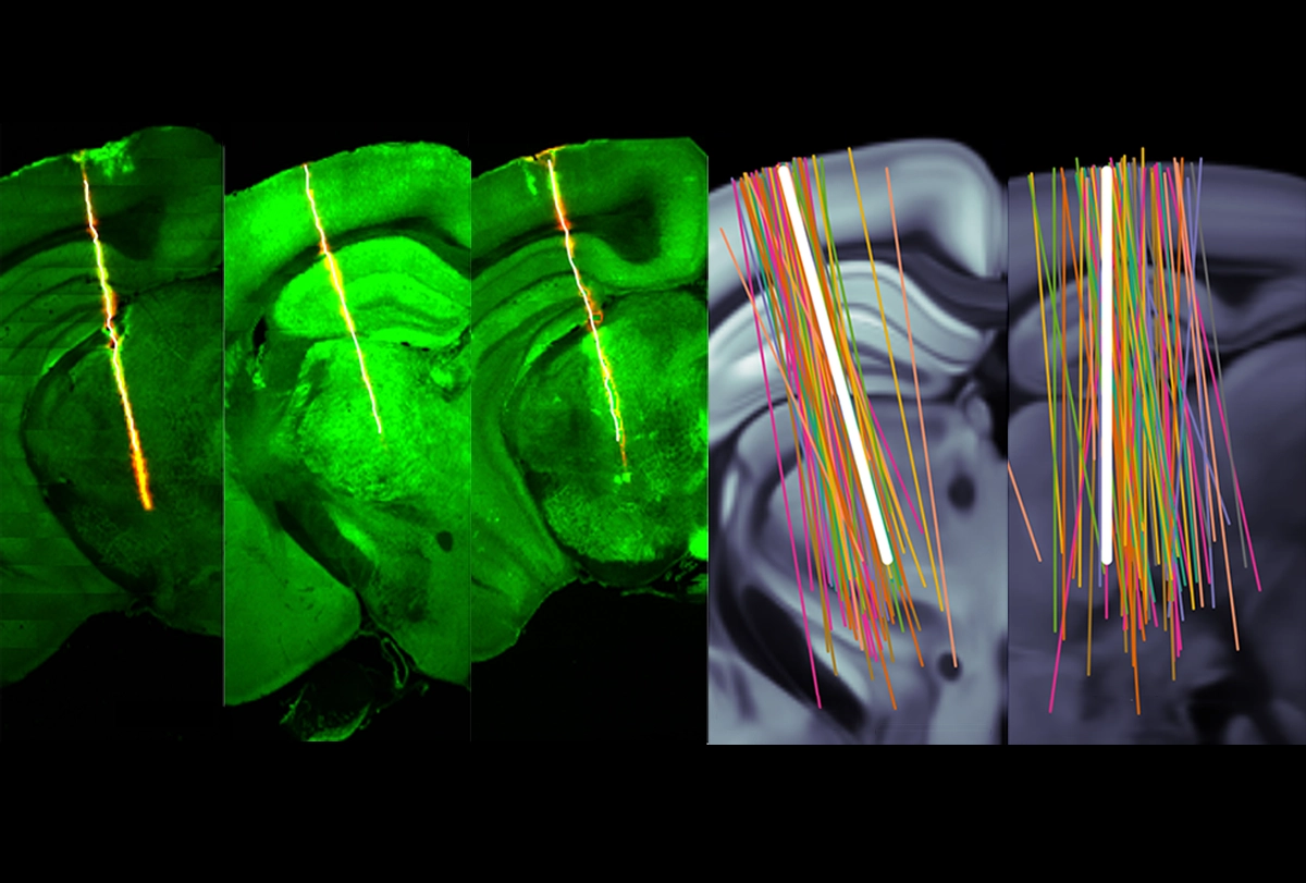 Research image of data from electrode arrays inserted into mice.