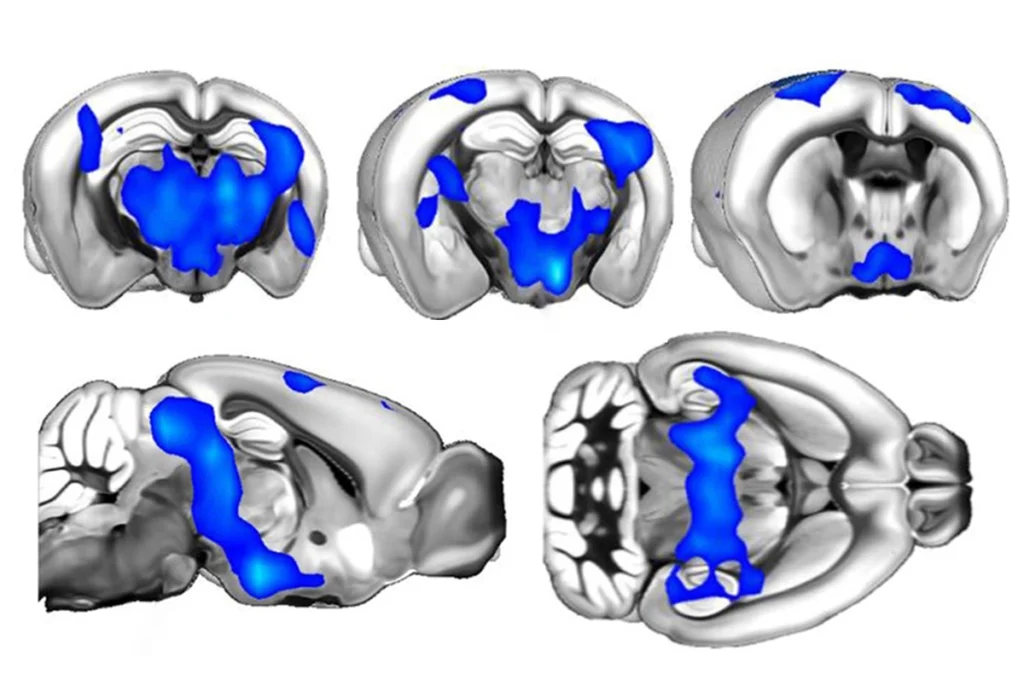 Research image showing connectivity in brain regions in female mice with and without a UBE3A variant.