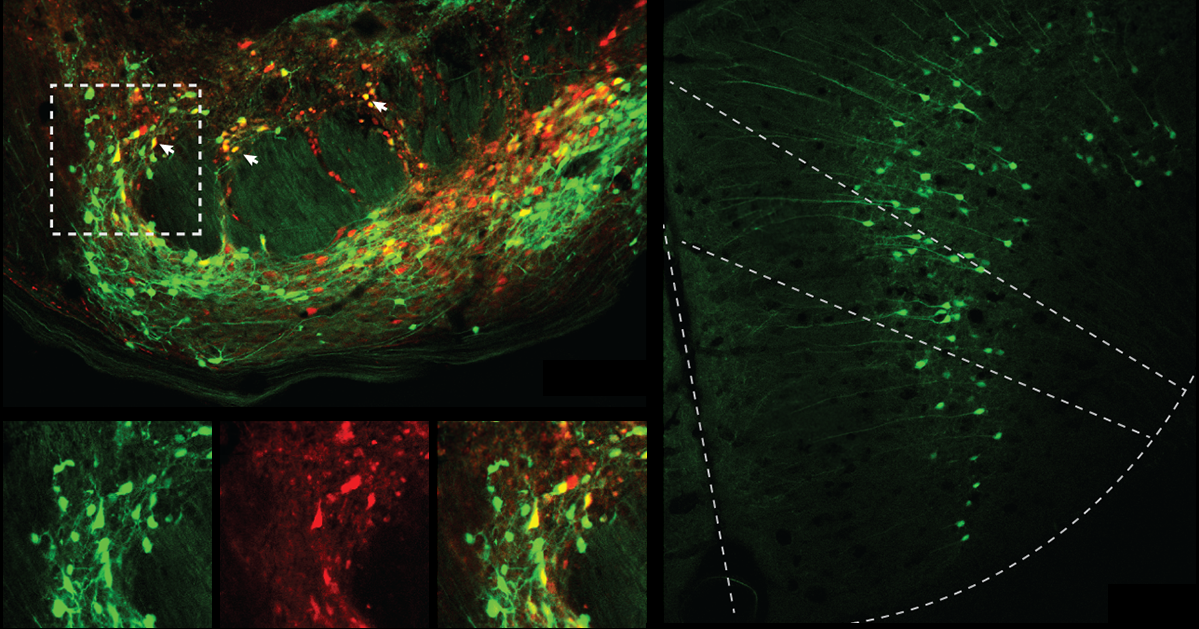 Cerebellar circuit may convert expected pain relief into real thing ...