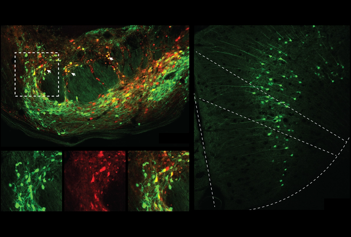 Research image of neurons in the rostral anterior cingulate cortex (right, in green) sending signals to cells in the pontine nucleus (left, in yellow) to quell pain.