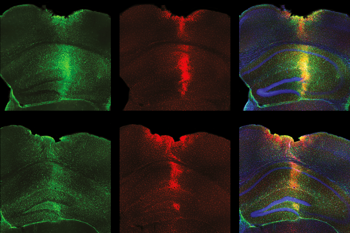 Research image of astrocytes and microglia in mouse brains.