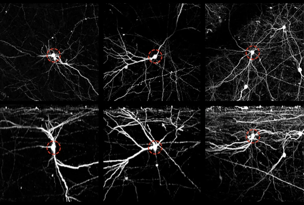 Research image of human neurons.