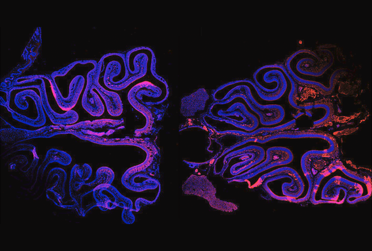 Research image of a brain chimera containing neurons from rats and mice.