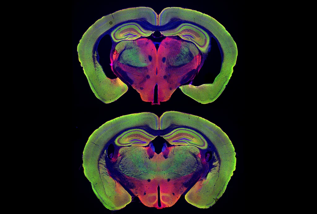 Research image of green and purple mouse brain slices.