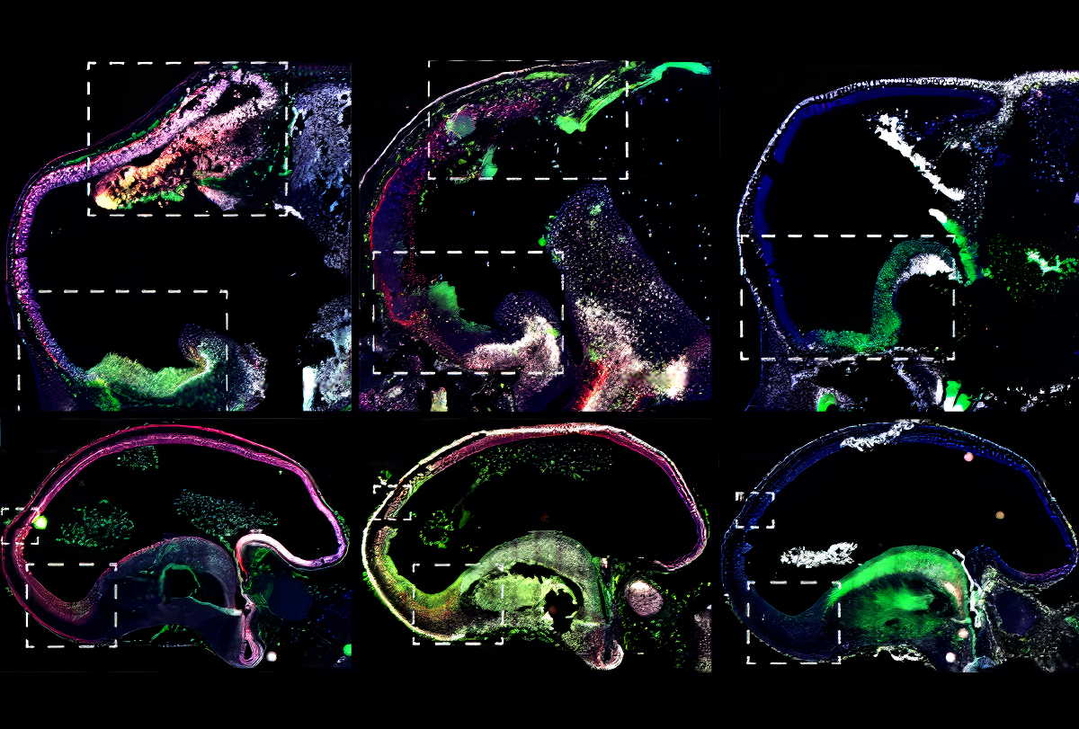 Research image of fetal macaque brains.