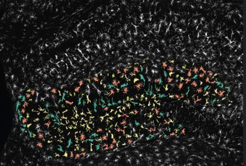 Research image of microglial forms color-coded into distinct categories.