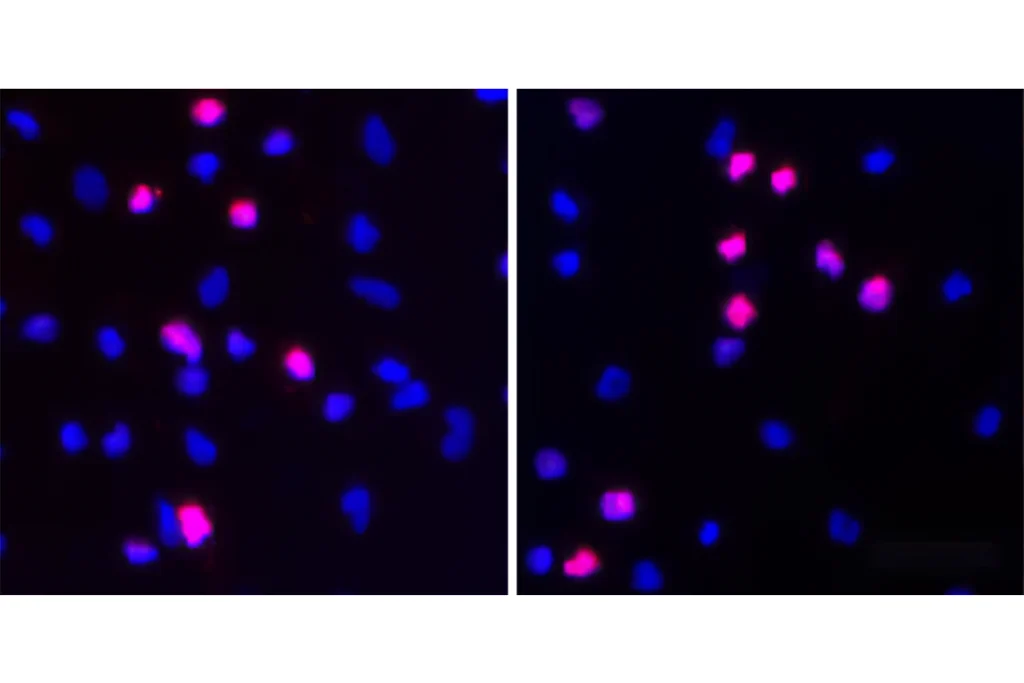 Research image of microglia.