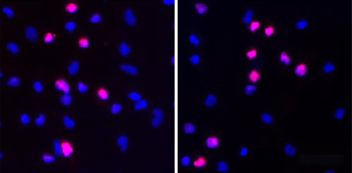 Research image of microglia.