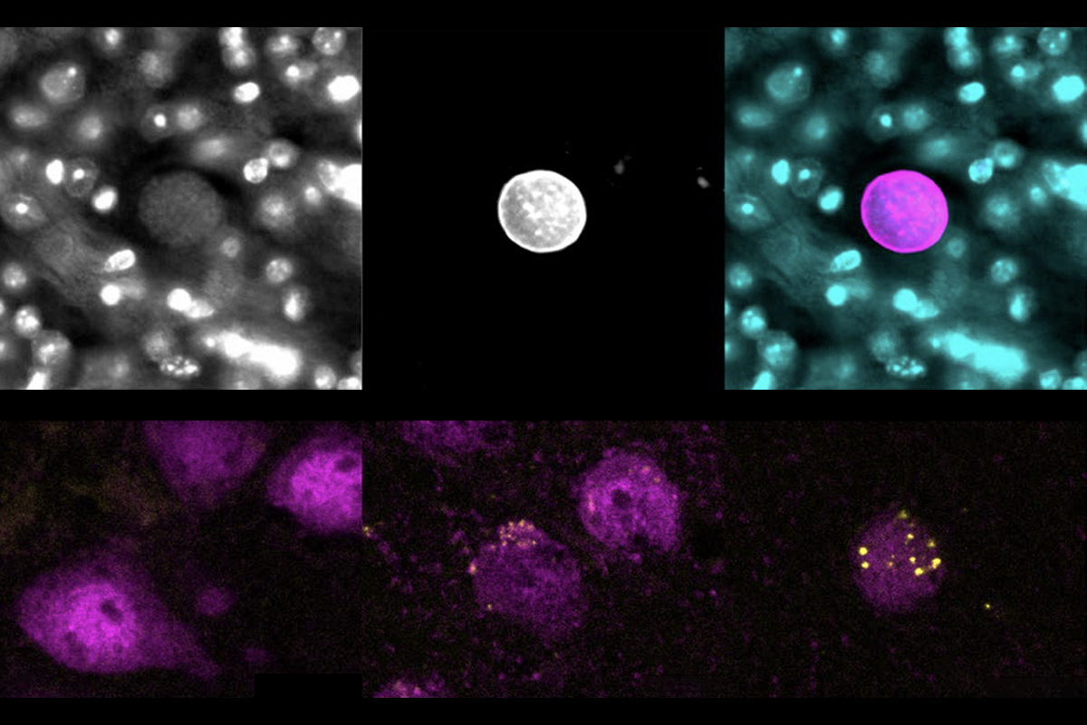 Research image of toxoplasma gondii showing cysts it creates as well as the MECP2 protein that it can deliver to neurons.