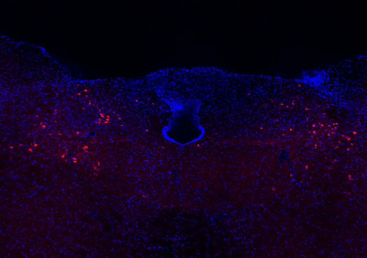 Research image of neurons in the nucleus of the mouse solitary tract.