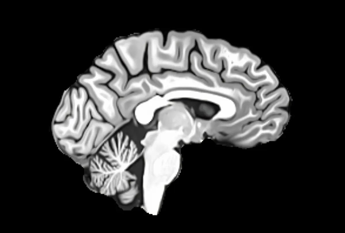 Research image showing gray-matter volume in a brain.