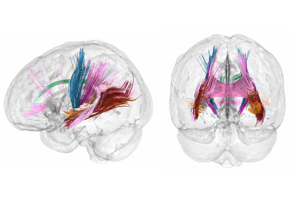 Research image of brain scans showing the structural integrity of white-matter tracts.