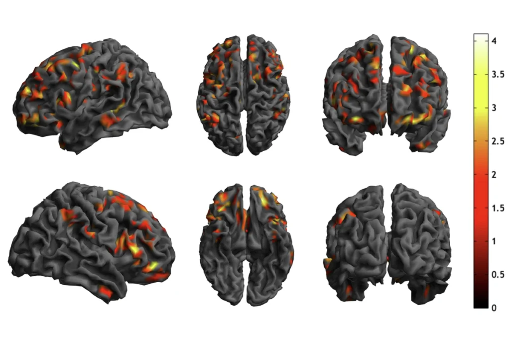 Research image of brain scans showing the density of neuronal synapses.