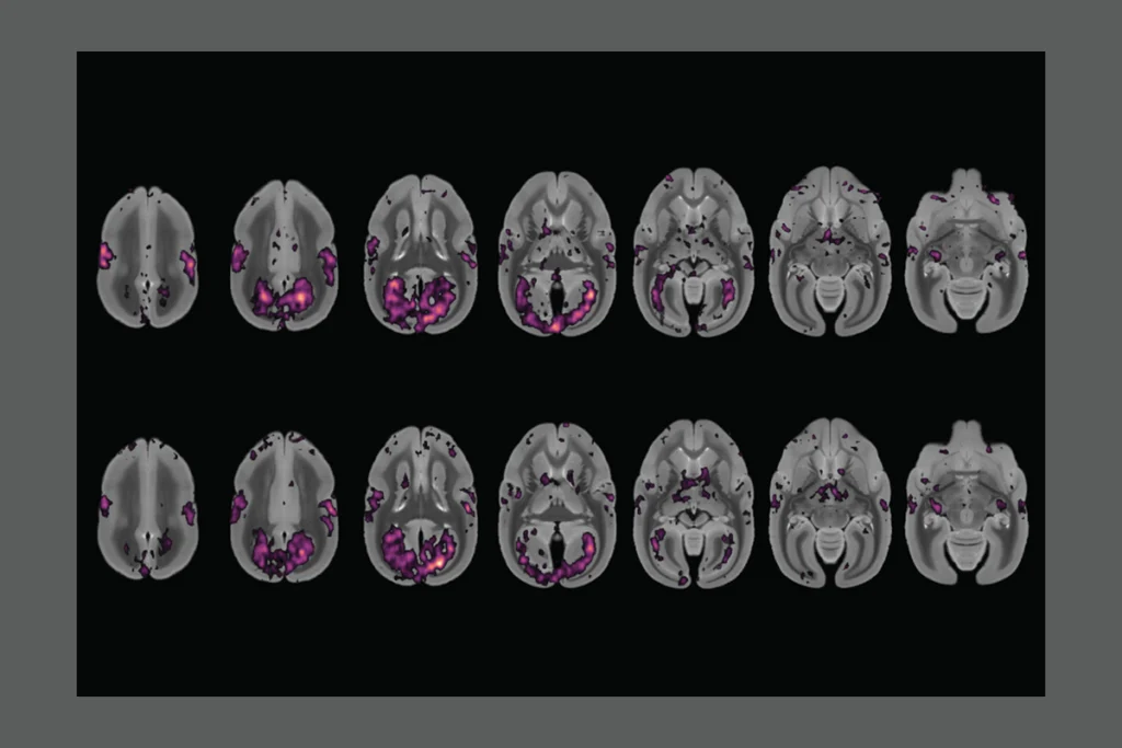 Research image of fMRI scans on a black background.