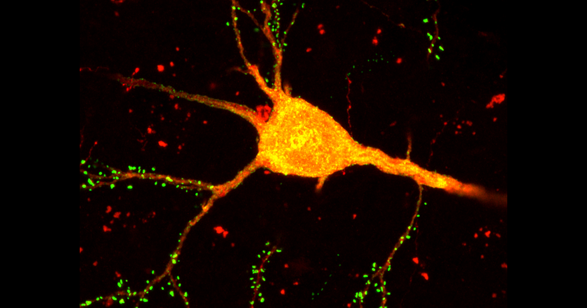 New Technique START Reveals Neuron Types and Connections in Mouse Brain