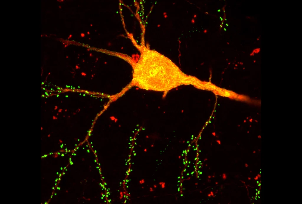 A cortical neuron glows orange and red.