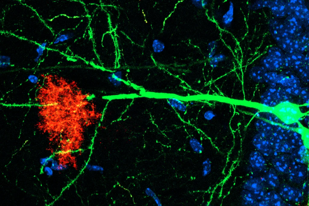 Research image of astrocytes in red activating alongside neurons in green in response to specific fear memories in mice.