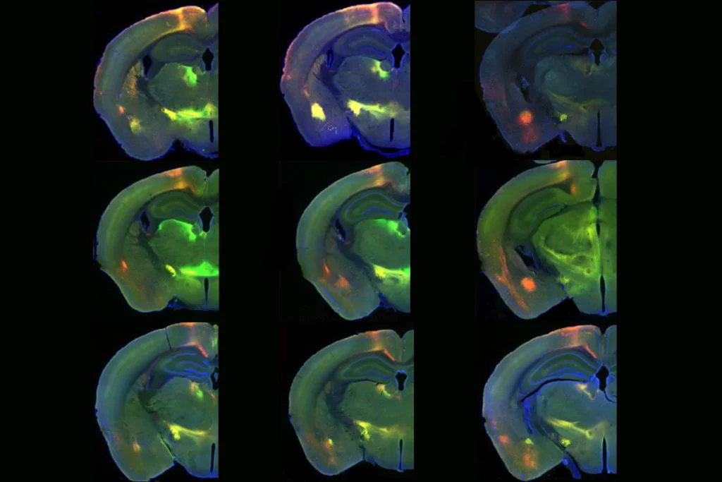 Research image of mouse brain slices.