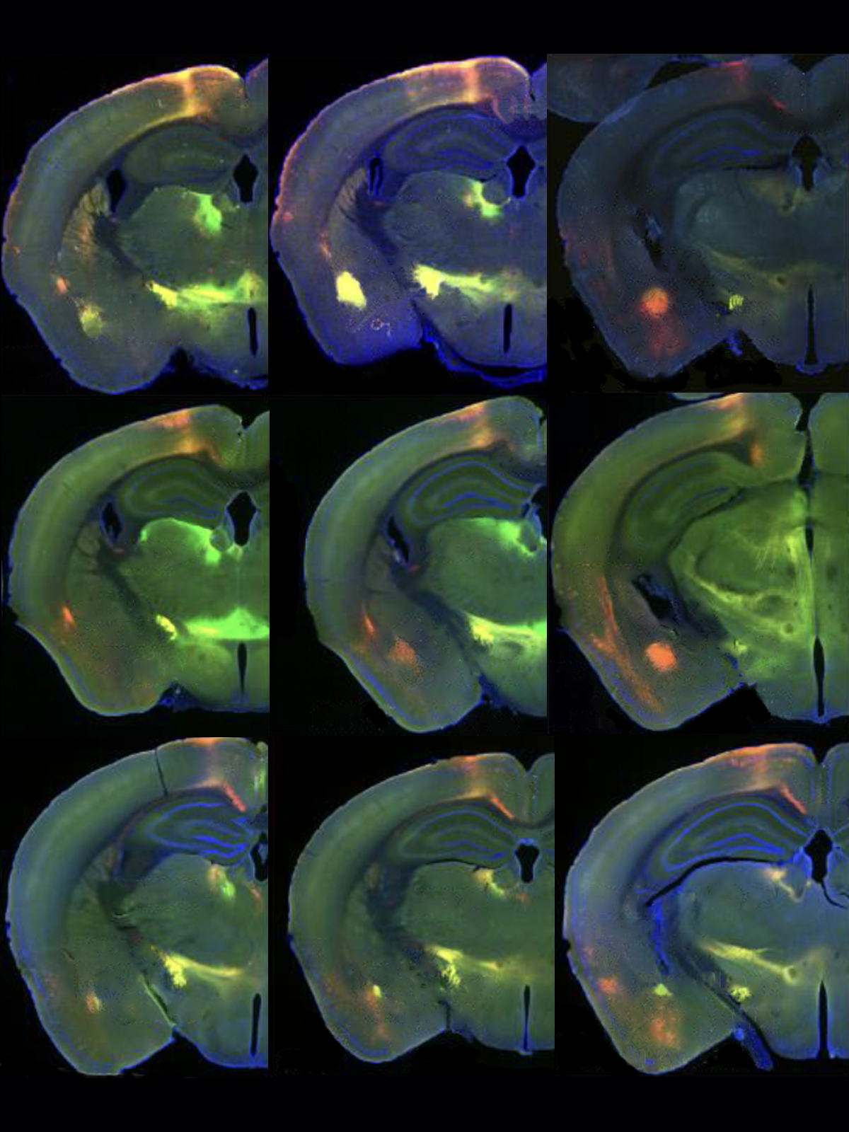 Research image of mouse brain slices.