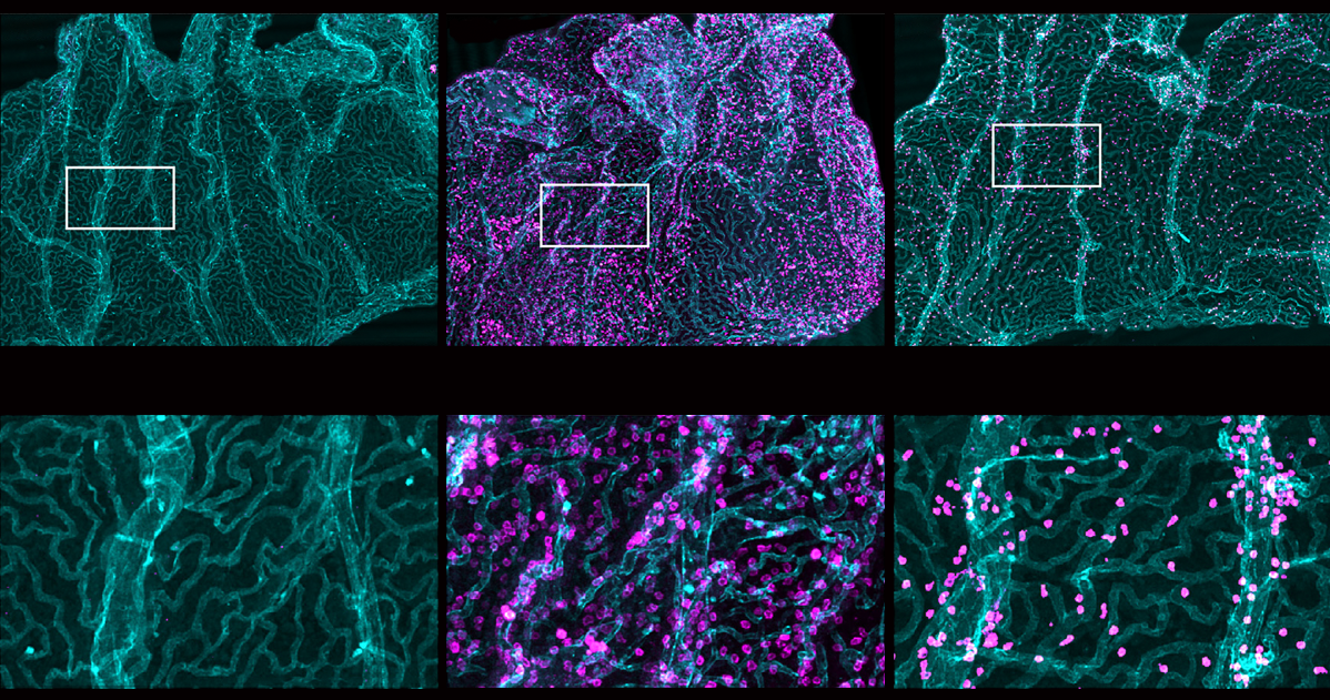 Immune cell interlopers breach—and repair—brain barrier in mice