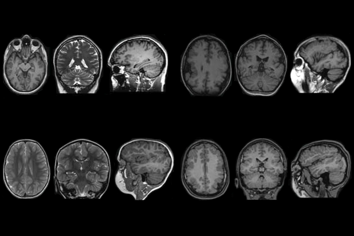 Research image of brain scans.