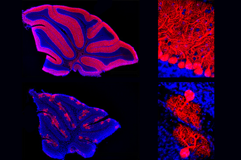 Research image of cerebellum damage in neonatal mice.