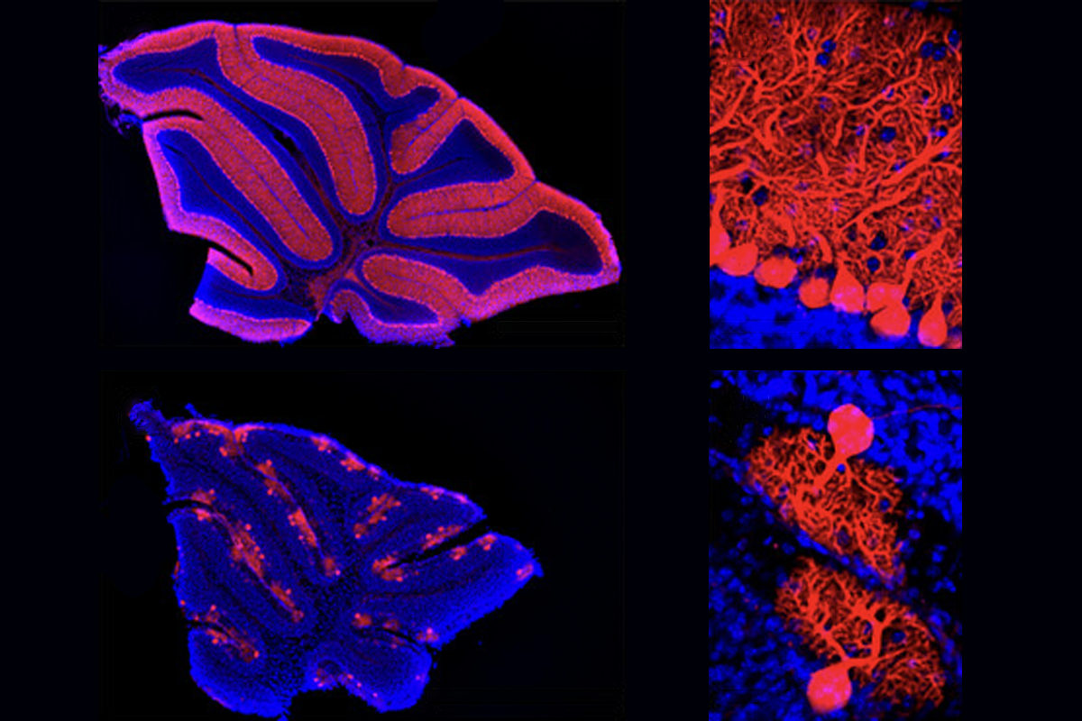 Research image of cerebellum damage in neonatal mice.