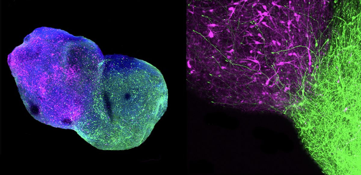 Research image of a thalamocortical assembloid.