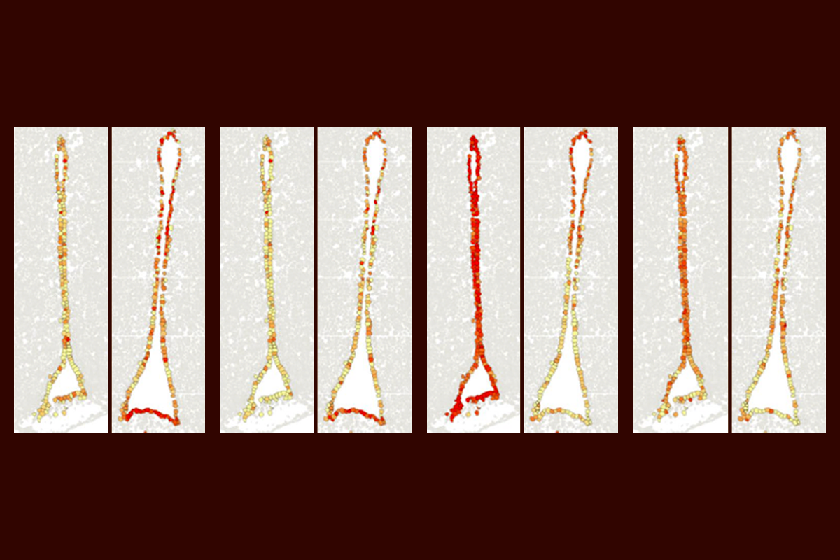 Research image of gene expression in cells in the third ventricle of the hypothalamus of young and aged mice.