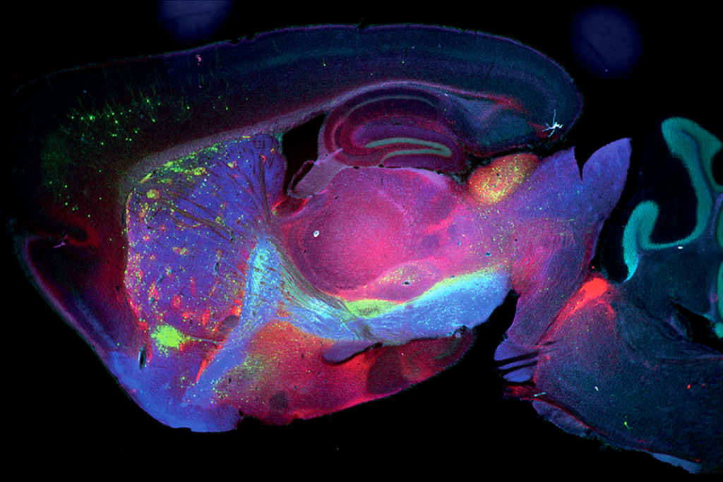 Research image of circuits emerging from striosomes in the striatum.