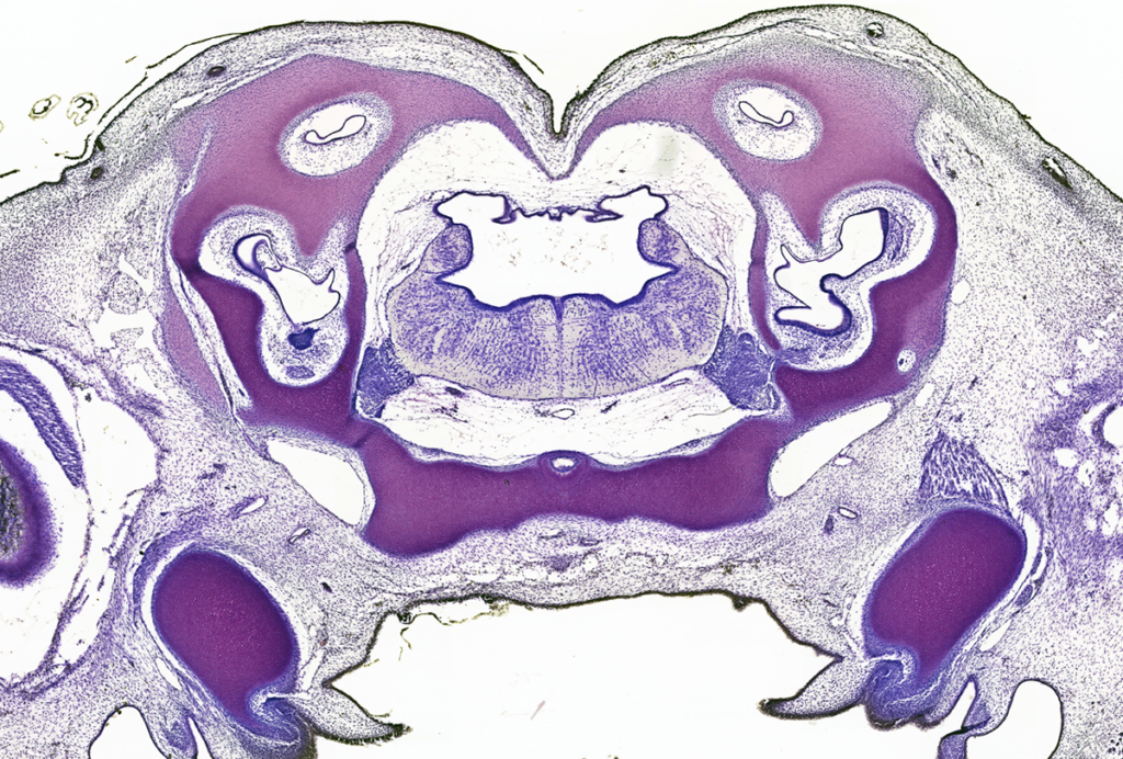 Violet-stained neurons in a serial transverse section from an embryonic spiny dogfish, a bottom-dwelling shark.