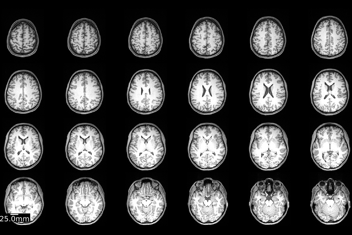 Grid of human brain scans.