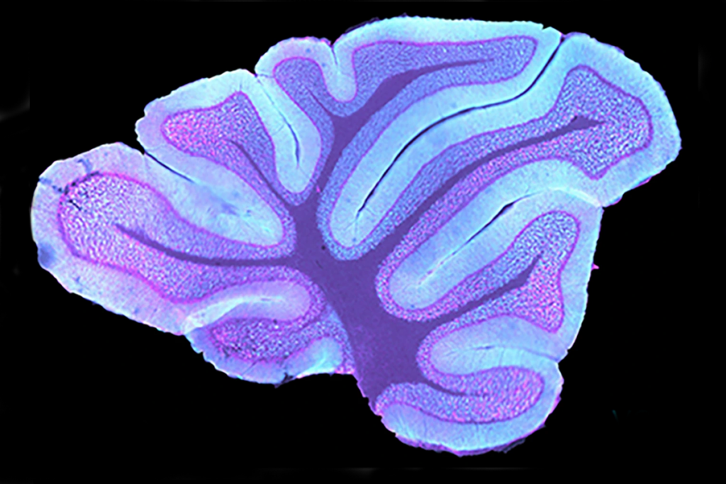 Research image of a mossy fiber terminal in the cerebellar granule cell layer.