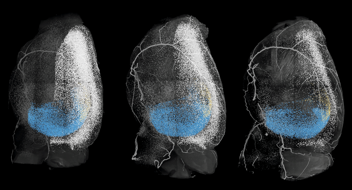 Research image of plaques in mouse brains.