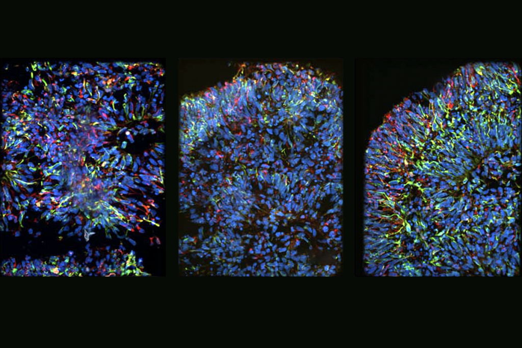 Research image of neural rosettes.