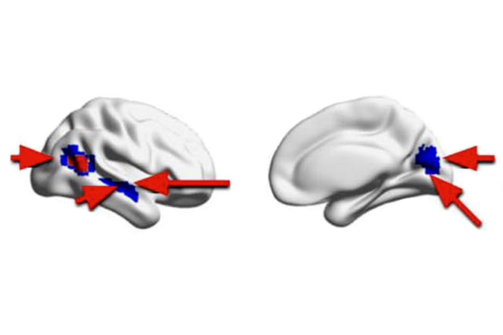 Research image of brain signaling.