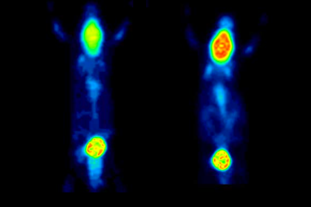 Research image of brain glucose levels in mice.