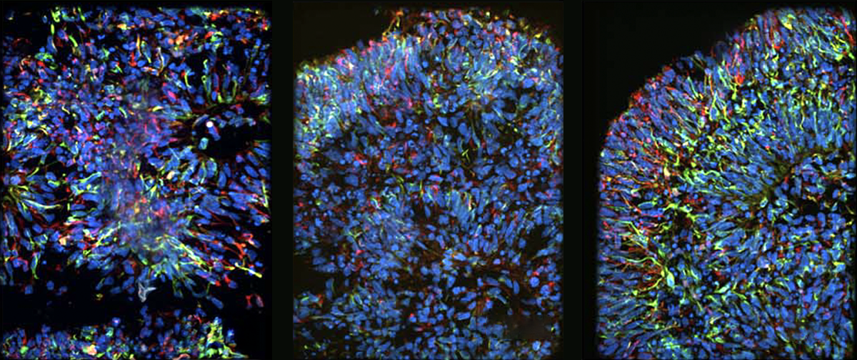 Research image of neural rosettes.