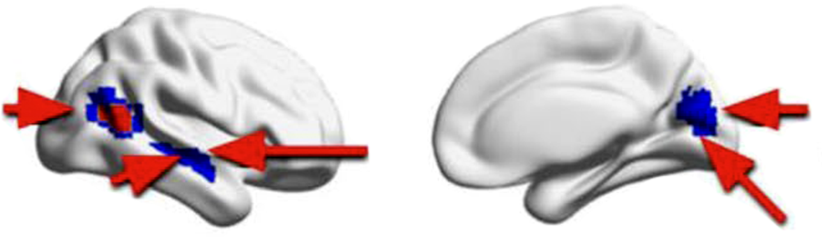 Research image of brain signaling.