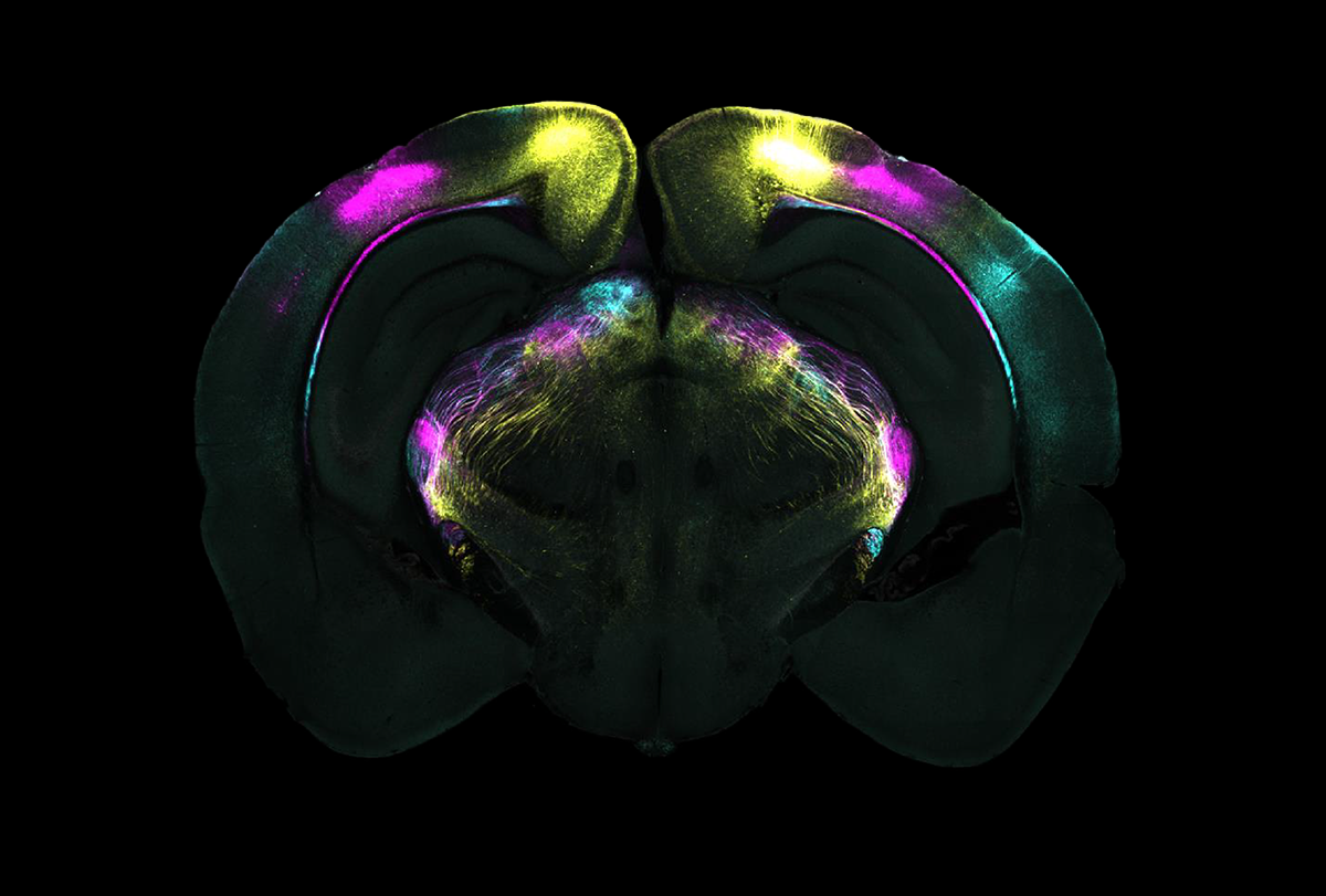 Research image of a mouse brain slice stained in purple and yellow.