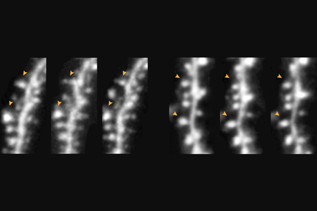 dendritic spine images