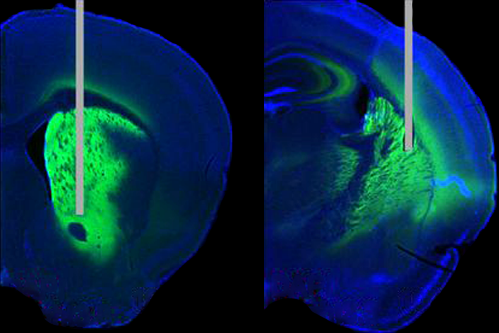 Research image of a fiber optic implant in a mouse brain.