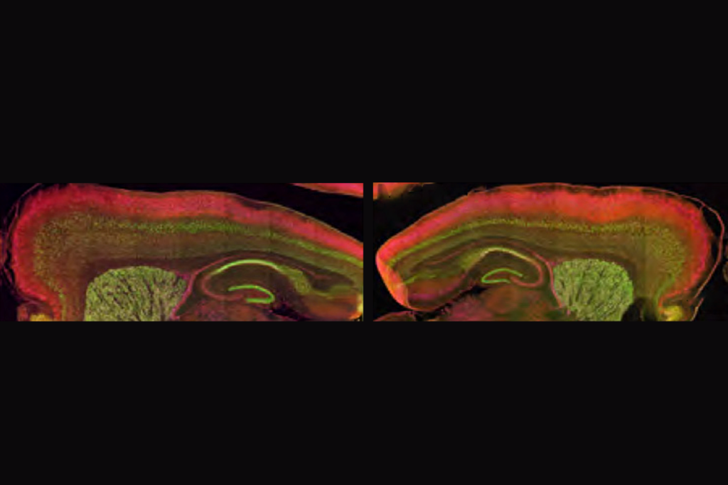 Research image of mouse brains showing altered migration of upper-layer neurons.