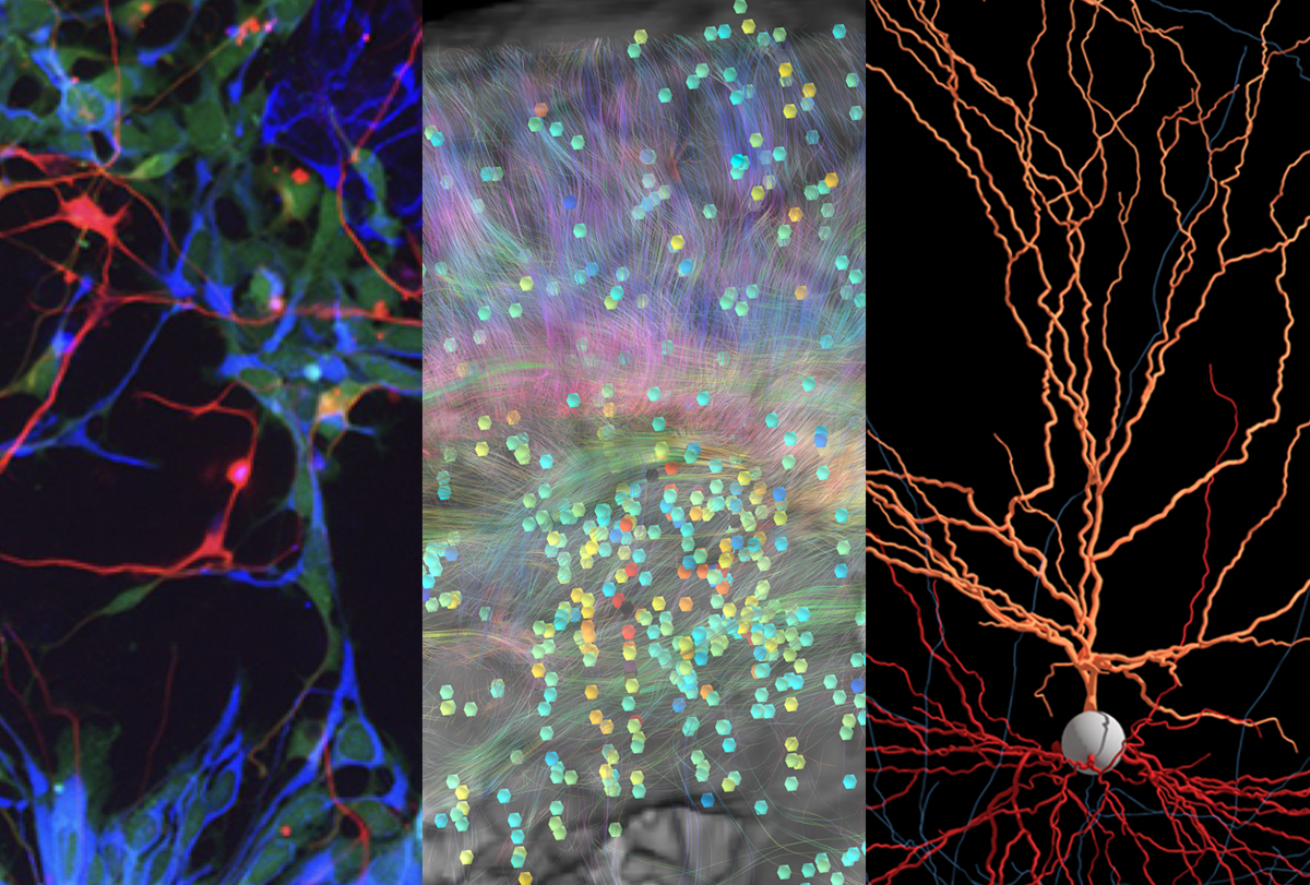 Composite of brain imaging techniques.